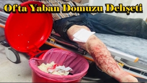 Trabzon'da Domuz Dehşeti 1 Yaralı