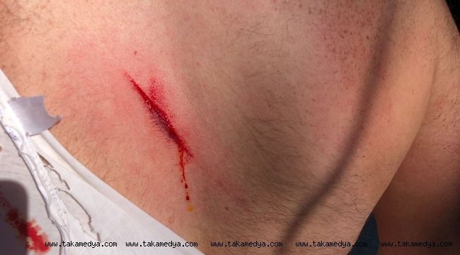 OF'TA MENFEZ KAVGASI 2 YARALI