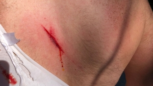 OF'TA MENFEZ KAVGASI 2 YARALI