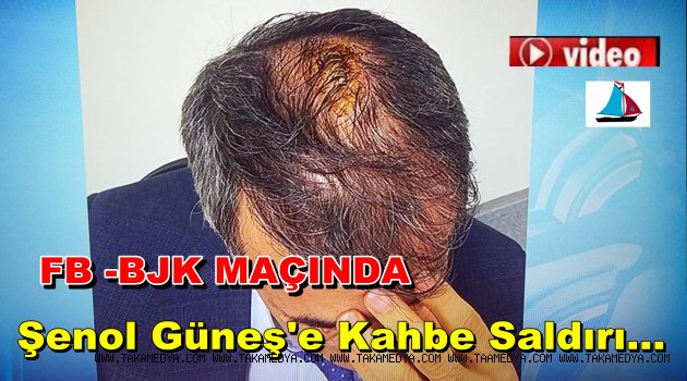 FB-BJK MACINDA ŞENOL GÜNEŞ'E SALDIRI HASTANEYE KALDIRILDI