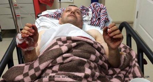 TRABZONLU MEHMET AYAR DARBECİLER TARAFINDAN VURULDU